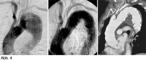 © Universitätsklinik für Radiologie und Nuklearmedizin 