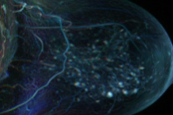 MedUni Wien|©Lorenz Perschy