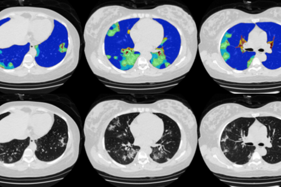 © Johannes Hofmanninger